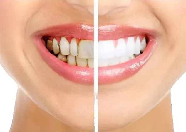 Гигиена зубов: Постоянный прикус