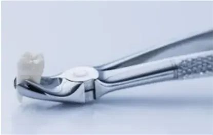 Быстрое и безболезненное удаление зуба профессиональным стоматологом - хирургом.