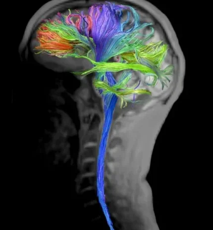 Фото для МРТ головного мозга с трактографией