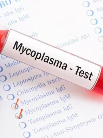 Анализ на микоплазиа певмония IgG