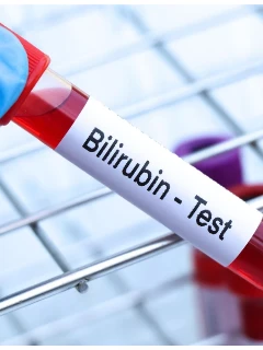 Анализ крови на синдром Жильбера