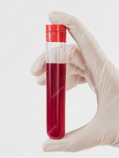 Анализ на глюкозу (венозная кровь)